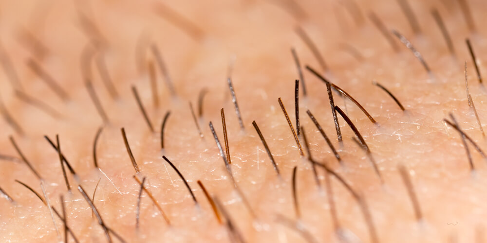 KÖŞE YAZILARIMIZ - KIL 